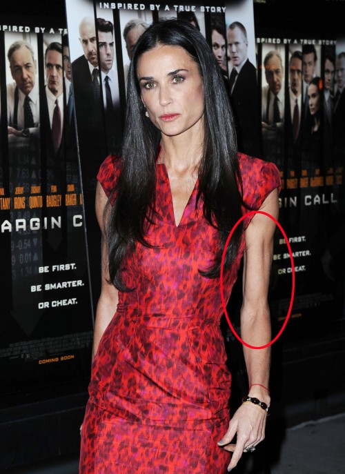 Demi Moore entre en cure de désintoxication