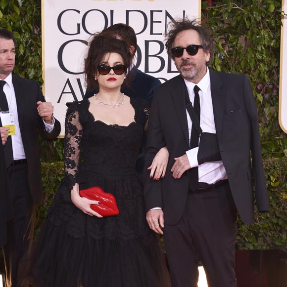 Tim Burton a un bras et une épaule cassés