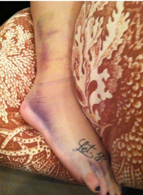 Demi Lovato se casse une jambe après une chute sur le plancher