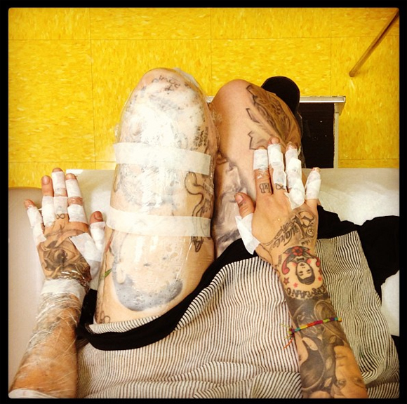 Kat Von D se fait enlever des tatouages au laser