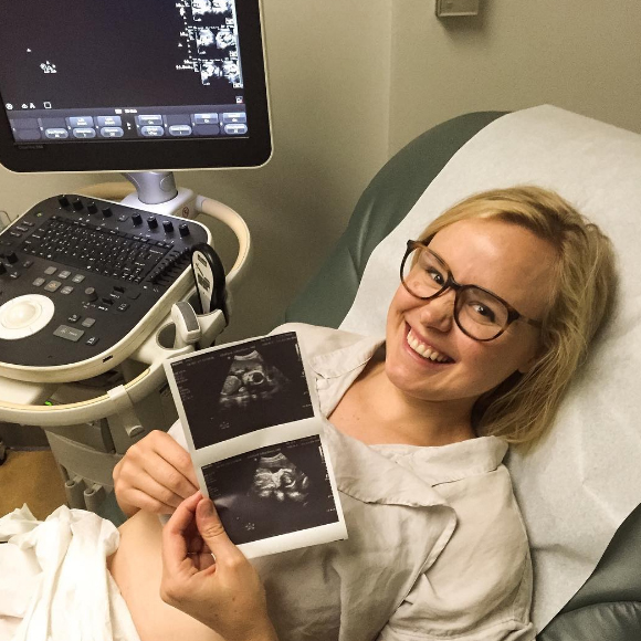 Alison Pill est enceinte!